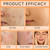 Organics Acne Balm Set, Acne & Redness Killer Balm with Squalane Oil, Calendula Extract, Sea Buckthorn, 4 in 1 Acne Cream for Anti-Wrinkle and Moisturizing, Suitable for All Skin Types, 1.05OZ / 30ML