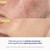 Skinfix Skin Barrier Restoring Gel Cream - 1.7 oz - Non-Greasy Moisturizer for Normal to Combination Skin - Hydrates, Plumps & Smooths - Non-Comedogenic, Fragrance Free, Vegan, Cruelty Free