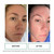 Replenix - Glycolix Elite Glycolic Acid Resurfacing Peel Pads - Medical Grade Brightening and Exfoliating Treatment, Travel Friendly Pads, 60 ct.