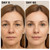 Micro Infusion System for Face,Micro System for face, (3*Applicators and 6* Serums)