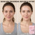 PDRN Facial Mask 10-Pack, Premium Salmon DNA & Collagen Sheet Masks for Radiant Glass Skin, Visibly Plumps Fine Lines & Restores Moisture Barrier, K-Beauty Anti-Aging Skincare
