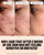 PEACE OUT Acne Face Serum with 2% Salicylic Acid (1 fl oz)