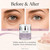 Agelyss Eye Bag Remover - For Dark Circles, Under Eye Bags, Puffiness, and Wrinkles - Brightening, Lifting & Hydrating Under Eye Cream - Paraben-Free, Fragrance-Free, Vegan - 1 FL OZ