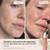 ALPYN 3-in-1 Barrier Repair Serum