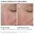 Dr. Brandt Needles No More Dermal Micro Points - 1.0 oz