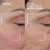 Dr. Brandt Needles No More Dermal Micro Points - 1.0 oz