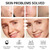 VGO Skin Care Set, Anti-Aging Moisturizing Repairing Soothing Snail Mucin Facial Skin Care Routine Kit for Dry Sensitive Dull Skin, 13.58 Fl Oz