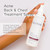 Glytone Chest & Back Acne Treatment Spray – 2% BHA Salicylic Acid with Gluconolactone – Body Acne Treatment for Bacne & Blackheads – Quick-Dry & Fragrance-Free Spray for Normal to Oily Skin – 8 fl oz