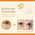 ReGlow Restore Microneedle Eye Patches for Immediate Skin Smoothing – Anti-Aging Under Eye Mask with Hyaluronic Acid, Collagen & Peptides – Helps Reduce Look of Dark Circles Puffiness & Fine Lines