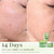 VELVENTE Matcha PDRN Korean Toner Pads, Dark Spots, Pores & Redness, Vegan
