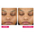 BeautyStat Exfoliating Peel Pads - AHA BHA Chemical Peel for Face