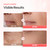 Dr.Different VITALIFT-A Forte Retinal 0.1%, Intensive Anti-Aging Cream for Wrinkle Reduction, Skin Elasticity, Lifting, Firming with Vita A, K-Skincare made by Korean Dermatologist.