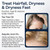 Psoriasis Scalp Spray - Dandruff Spray with Salicylic Acid 3% Treatment for Flaking, Itching & Dryness - Fast-Absorbing Scalp Relief for Dandruff, Folliculitis, Seborrheic Dermatitis & Eczema