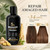 ssumiao 5% Minoxidil Shampoo and Conditioner Set for Hair Growth, Biotin Ginseng and Ginger Hair Regrowth Shampoo for Thinning Hair, Scalp Care for Men and Women, Thicker Fuller Hair, 600mL Duo