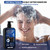 Anti-dandruff & Antifungal Shampoo,Sulfate & Paraben-Free, 10.1 Fl Oz