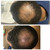 Kreyol Essence - Scalp Care Conditioner with Haitian Black Castor, Coconut oil and Aloe Vera Oil, 8 Oz