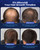 Minoxiva 5% Minoxidil Topical Solution for Men with Spray Nozzle - Hair Growth Treatment for Thinning Hair & Beard, Non-Greasy & Fast-Absorbing Serum, 2-Month Supply (2 x 2oz/60ml)