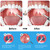 Upgraded Tonsil Stone Remover with Camera, Visual Tonsil Stone Removal Kit with 6 LED Light, Tonsil Stone Removal Tool Camera with 1080P, 5 Head Attachments, for iOS & Android (Black)