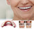 DENTUREWAY DIY Denture Kit with Impression, Do-It-Yourself Partial Denture Solution, Small