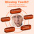 Partial Dentures for Men & Women, Custom Removable Replacement Tooth Set for Missing Teeth & Gap (Two Teeth)