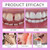 Functional dentures, Adjustable Functional Full-Mouth dentures, Premium Style, Custom-Made Silicone Full-Mouth Denture Set, Premium Style, for Men and Women-2-piece