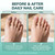 Swissklip Medi-Care Toenail Stick I KlearNail Treatment | Natural Solution for Healthy Nails I Suitable For Foot, Toe, and Fingernail I For Brittle Toenails – 10ml / 0.3 Fl. Oz. Pack 3 - Made in USA