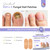 SAVILAND Extra Strength Fungal Nail Patches FSA-HSA: 64 Patch Overnight Repair 1% Tolnaftate Toenail Treatment Nighttime Nail Renewal Restores Damaged Nails Discolored Thick Yellow