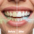 Puur Smile Oral Probiotic Lozenges for Fresh Breath & Gum Care | 7 Billion CFU Probiotic Blend with S. Salivarius & Digestive Enzymes | Mint Flavor | Daily Oral Care Supplement | 30 Lozenges
