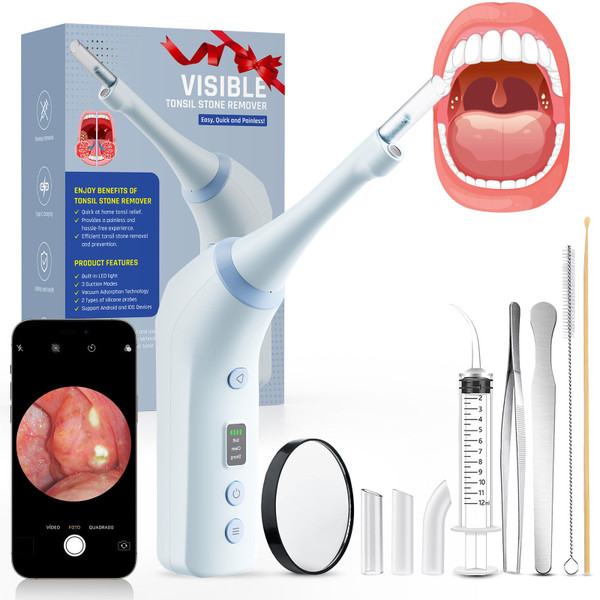 Electronic Tonsil Stone Remover with Camera, Tonsil Stone Removal Kit, 3 Suction Levels, Tonsil Stone Vacuum, Oral Care for Mouth Health, USB Rechargeable(Blue)