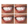 Let Those Pearly Whites Shine Postcard Laser Smile w/Teeth Postcard, 200/Pkg., RC3239