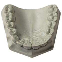 Modern Materials Die Keen Die Keen - Type V Dental Gypsum, Green Regular Set
