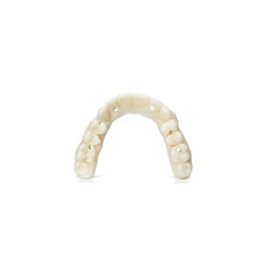 Keydenture Try In