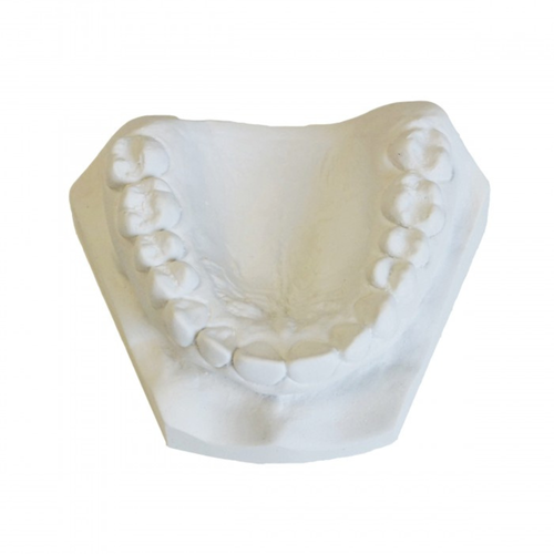 Modern Materials Denstone White Stone, Regular Set, 25 Lb. Box