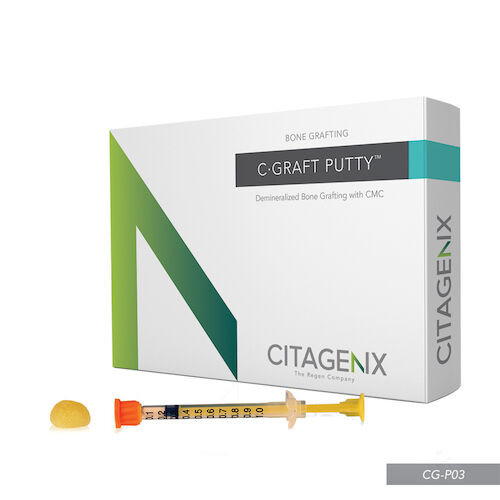 C-Blast Putty 0.3 cc, Syringe