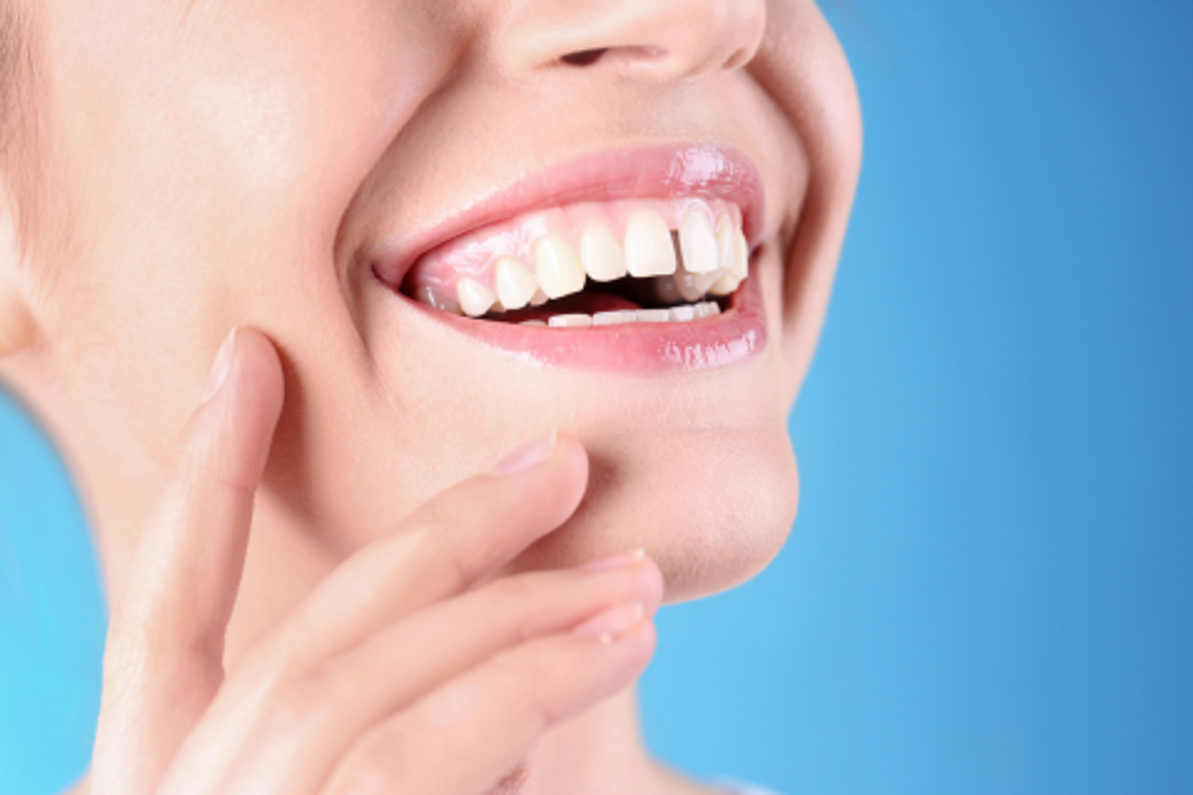 Diastema (strungareata) - cauze si solutii