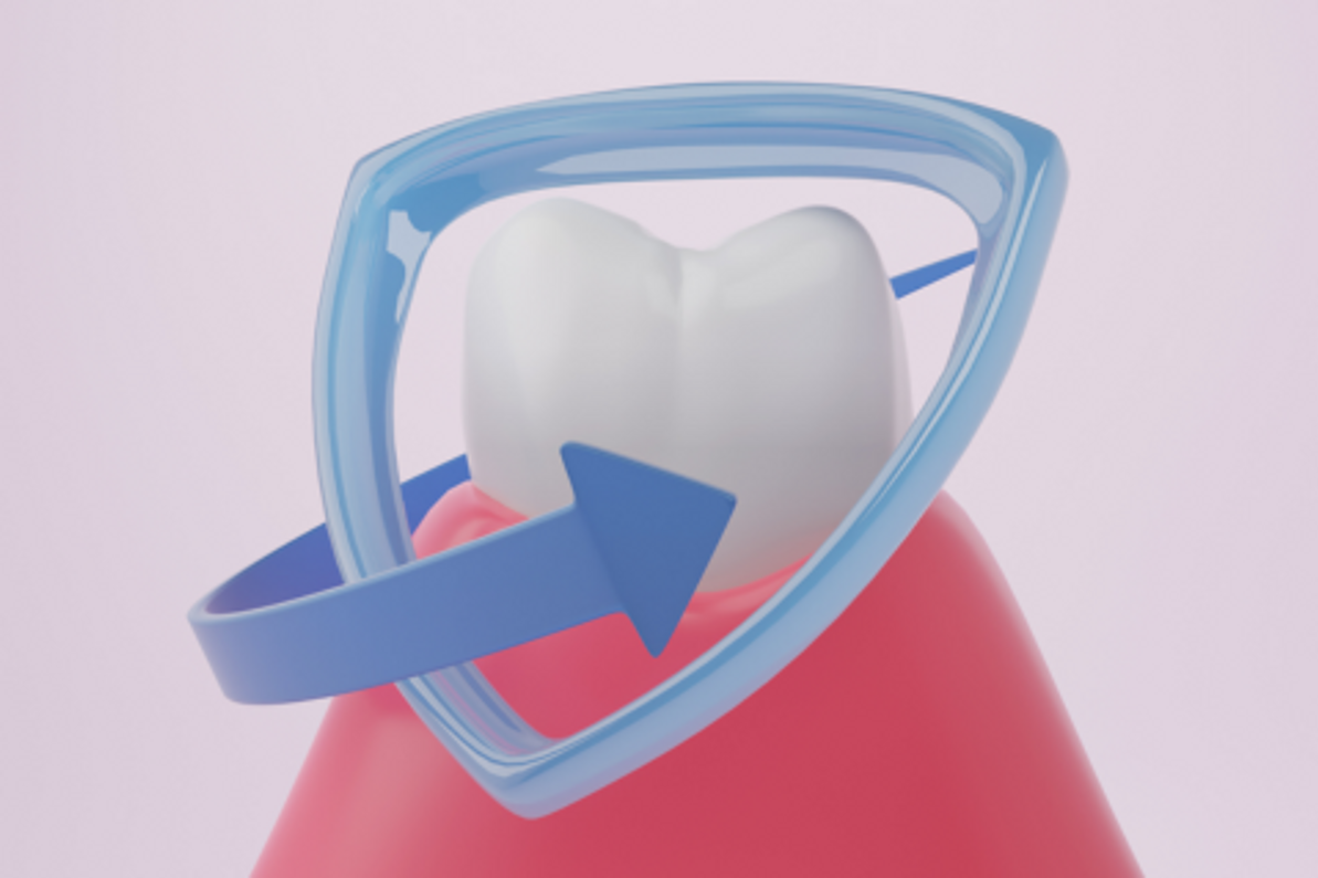 Periodontita - cauze, manifestari, tratament 