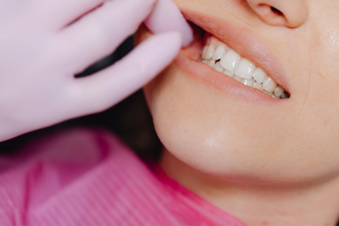 Totul despre periuța interdentară | Ghid Dentamerica Distribution