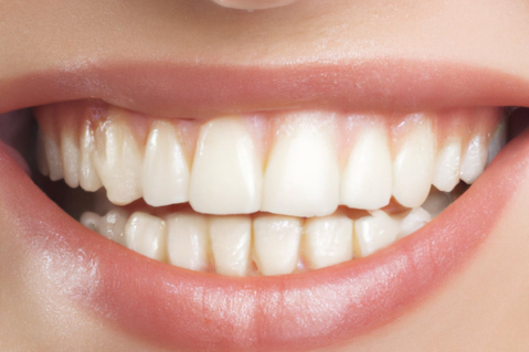 Smalțul dentar: rol și protecție | Ghid Dentamerica Distribution
