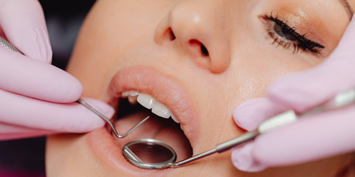 Fluorul din pasta de dinți contribuie la reducerea riscului de carie, stopează evoluția cariilor existente și protejează obturațiile. 