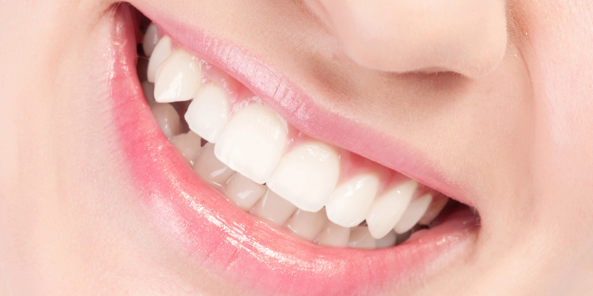 Periajul corect, curățarea interdentară, dieta echilibrată, hidratarea corespunzătoare sunt metode prin care petele albe pot fi prevenite.