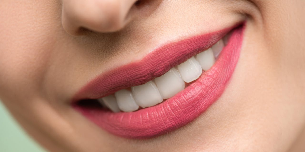 Produsele de igienă profesionale și o tehnică de periaj corectă contribuie la un control eficient al sensibilității dentare.