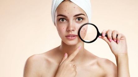 When acne isn't acne? Skin conditions that look like acne!