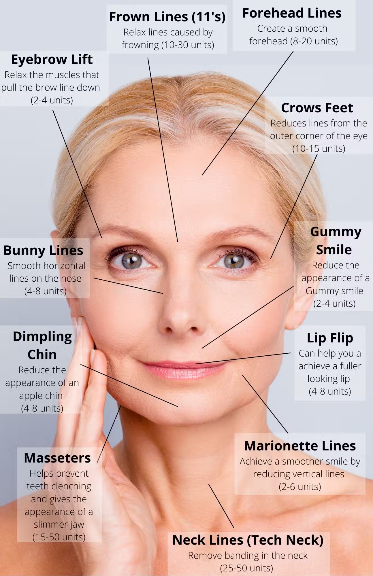 Face map for botox injectable points