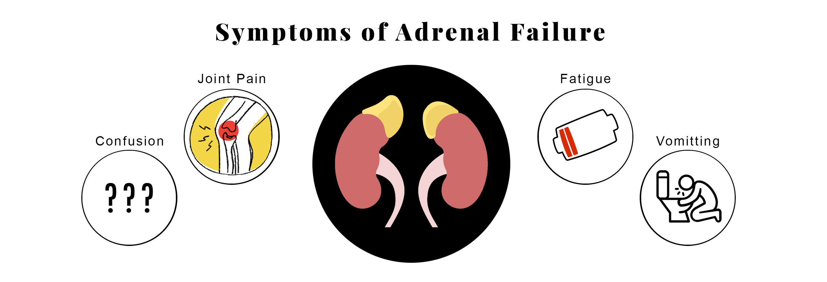 The Four Phases of Adrenal Failure Cincinnati Health Institute