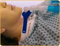 Vent Circuit Anti-Disconnect Device  (1/EA)