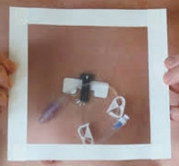 IV Site Barrier Protector HydroSeal 5 X 5 Inch (M-1136590)