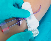 Catheter / Line Securement Device Grip-Lok® (M-1137875)