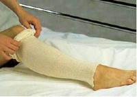 Stockinette Tubular Albahealth® 3 Inch X 25 Yard Cotton NonSterile (M-243650)