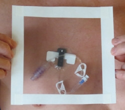 Arm Cast Protector HydroSeal Sleeve One Size Fits Most Plastic  (100/CS)