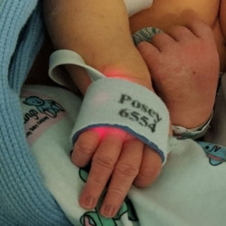 SpO2 Sensor Replacement Wrap  (1/EA)